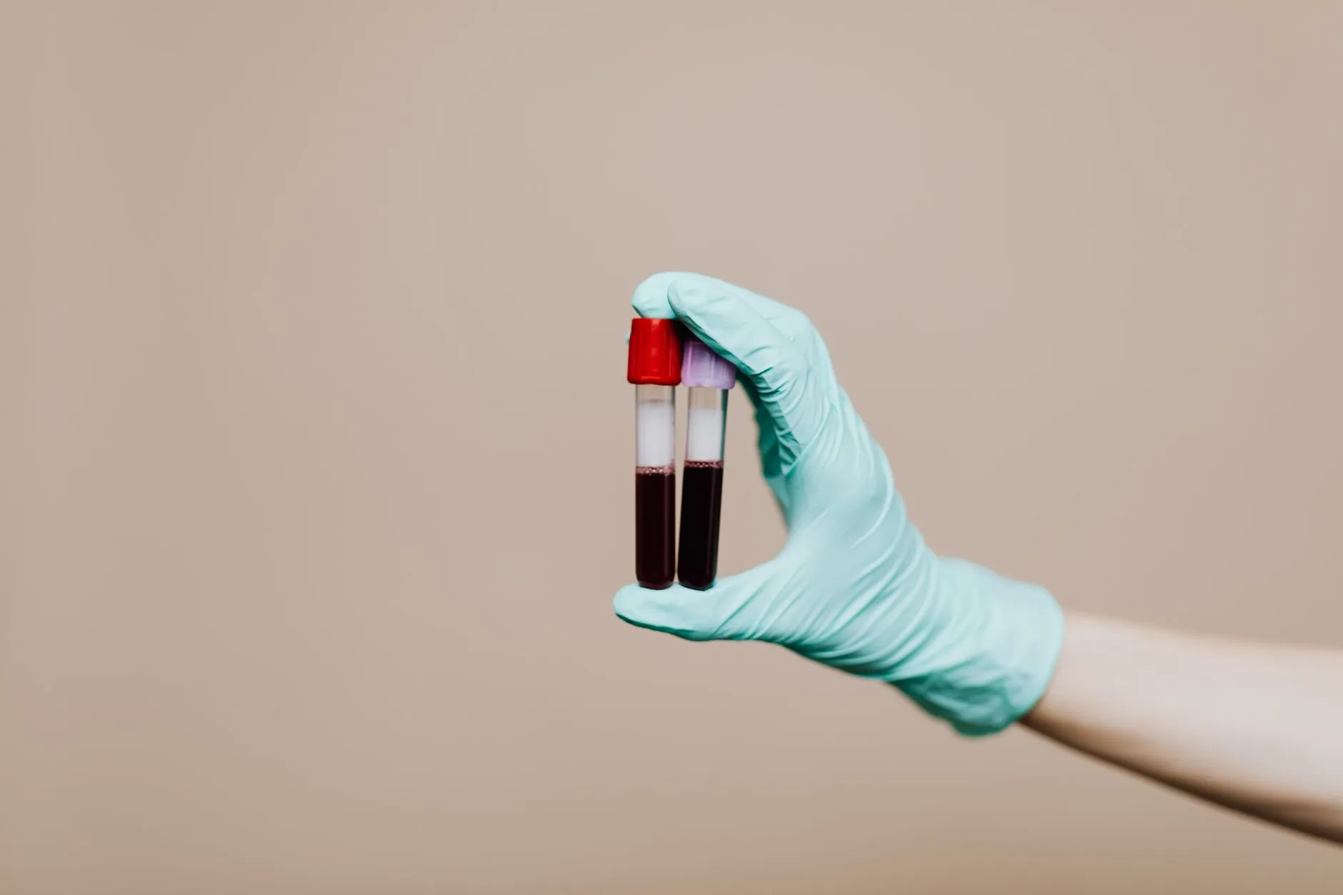 A gloved hand holding a blood sample tube